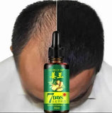 Aichun Beauty 7 Days Ginger Hair Growth Oil Serum For Damaged Hair Treatment- 30ml AC3058