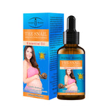 Aichun Beauty Natural Snail Extract Skin Care Repair Treatment Stretch Marks Oil 30ml -AC226-4