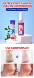 Aichun Beauty Foot Cream Balm For Cracked Heel Dead Skin Remover Foot Cream Anti-Crack Deep Moisturizing Foot Cream For Feet Skin Healing Feet Dry Feet Callus Remover 20g AC 2042