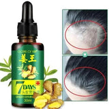 Aichun Beauty 7 Days Ginger Hair Growth Oil Serum For Damaged Hair Treatment- 30ml AC3058