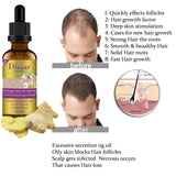 Disaar Natural Ginger Hair Care For Men And Women Hair Loss Powerful Hair Growth 30ML DS325-2